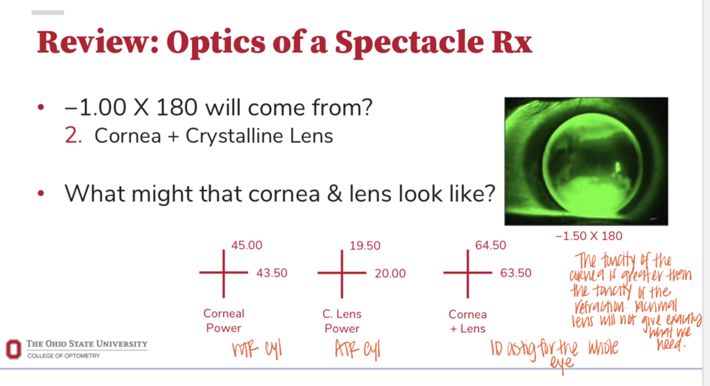 <p>Corneal & Crystalline Lens Astigmatism Example (Pic)</p>