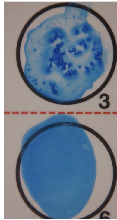 <ul><li><p>- bacteria?</p></li></ul><p></p>