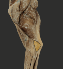 <p>What muscle is highlighted in the picture?</p>