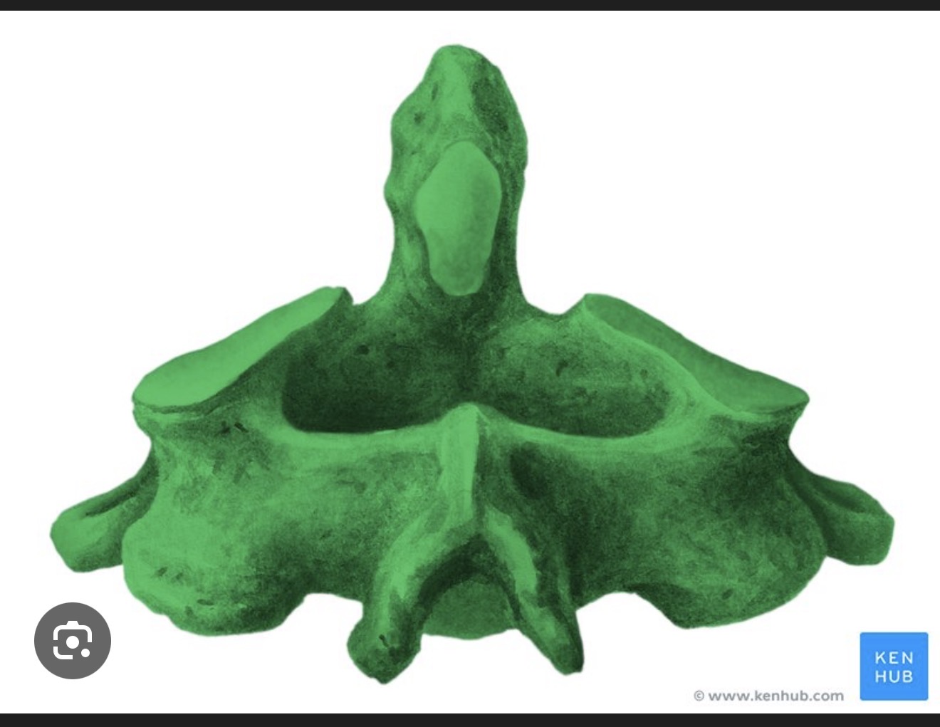 <p>axis or C2 of the cervical vertebrae is the second cervical vertebra, which allows for rotation of the head and supports the atlas. </p>