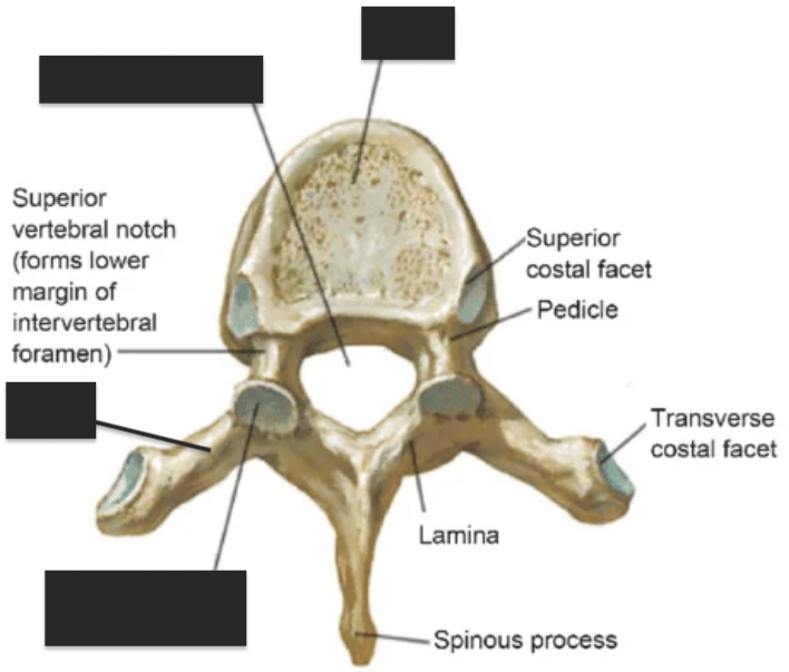 <p>name the 4 tagged areas from top to bottom </p>