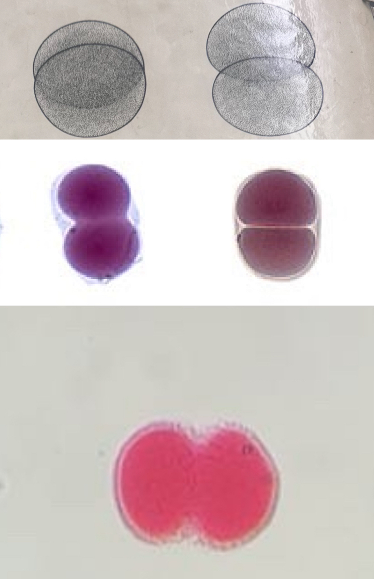 <p>Developmental stage</p>