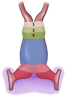 <ul><li><p>bulbus cordis</p><ul><li><p>truncus arteriosus</p></li><li><p>conus cordis</p></li><li><p>primitive right ventricle</p></li></ul></li><li><p>primordial ventricle</p></li><li><p>primordial atrium</p></li><li><p>sinus venosus </p></li></ul><p></p>