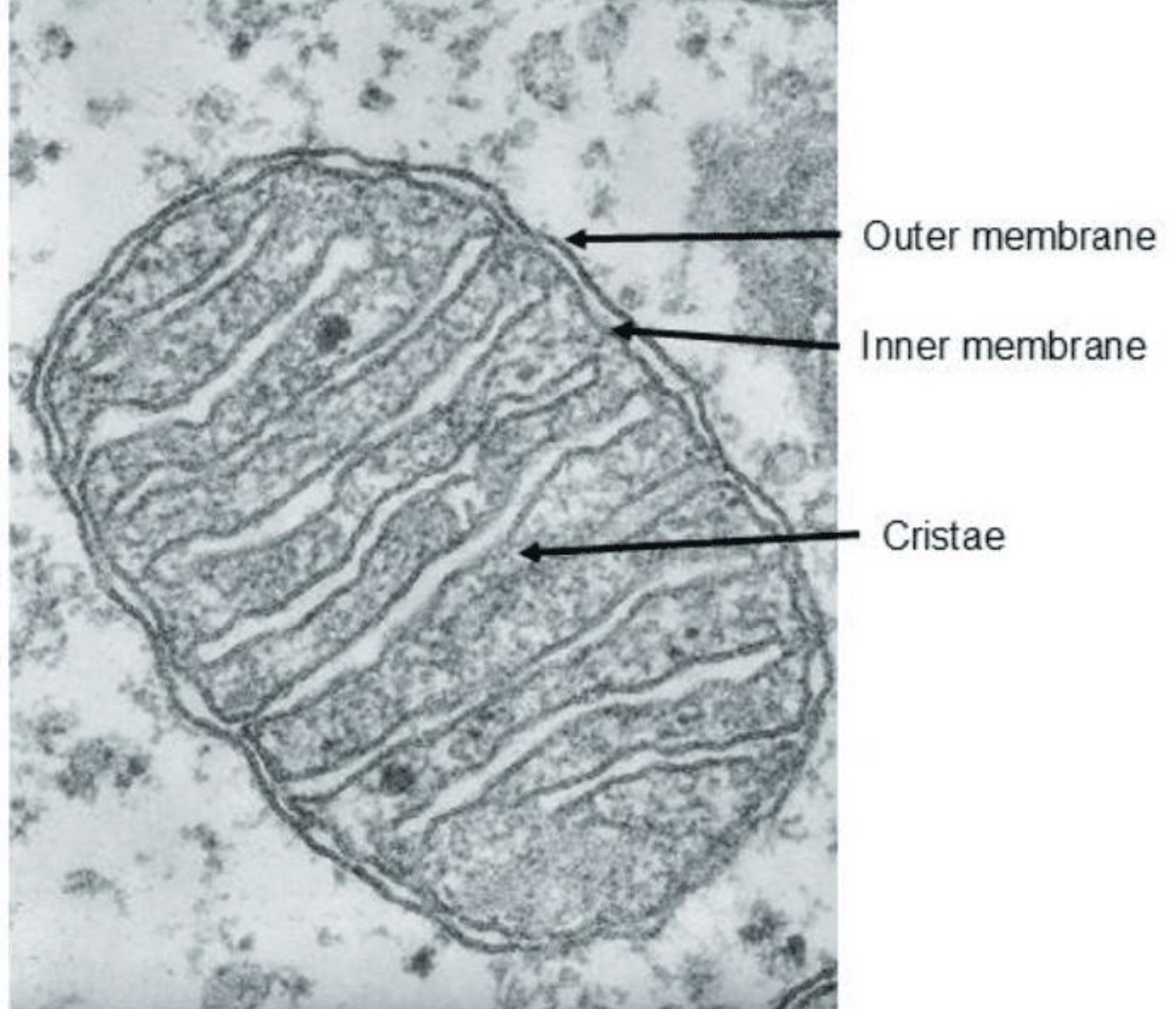 <p><strong>Scattered throughout the cytoplasm</strong>, often between other organelles.</p>