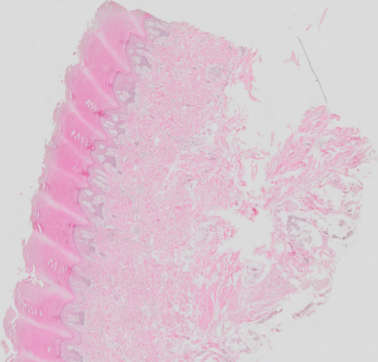 term image