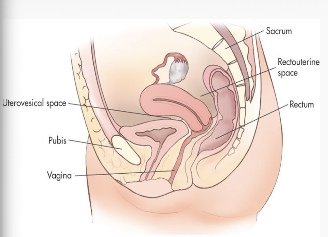 <ul><li><p>collapsed muscular tube</p><ul><li><p>approx. <mark data-color="#d876e0" style="background-color: rgb(216, 118, 224); color: inherit;">9 cm </mark>in length</p></li><li><p>90-degree angle w/ the cervix</p></li></ul></li></ul><p></p>