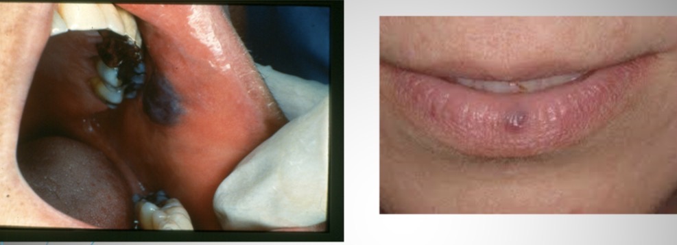 <p>What is this condition?</p>