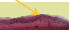 <p>What is this slit like organelles that attach to hosts small intestines on Speudotapeowrms</p>