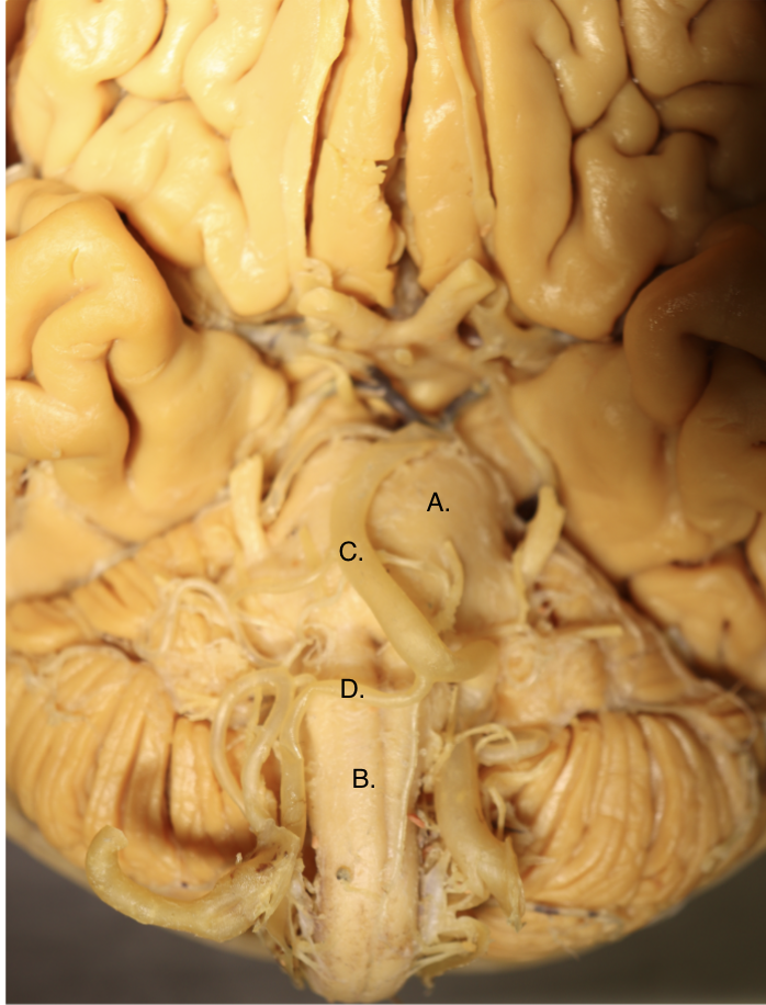 <p>Identify these 2 structures and 2 arteries</p>