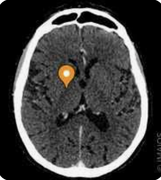 <p>Name the major white matter tract, modality, and plane</p>