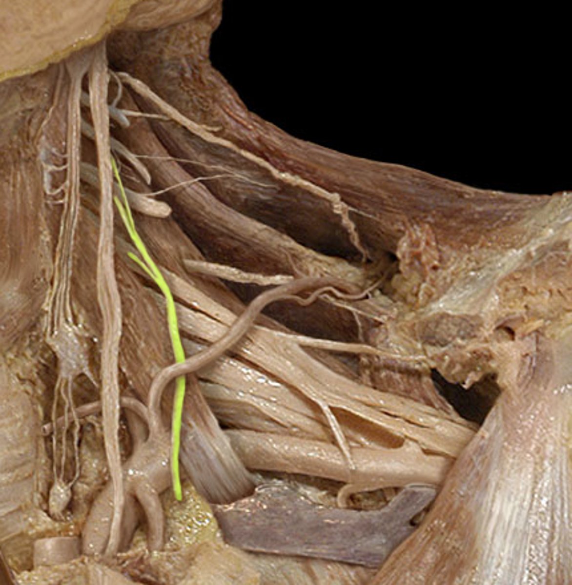 <p>Phrenic nerve</p>