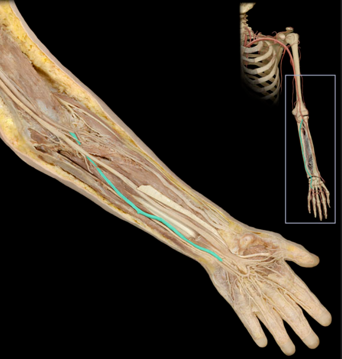 <ul><li><p><strong>Origin: </strong>Brachial</p></li><li><p><strong>Course: </strong>Passes distally along medial aspect of forearm</p></li><li><p><strong>Distribution: </strong>Medial forearm muscles, Hand muscles, and Joints of elbow and hand</p></li><li><p><strong>Branches:</strong></p><ul><li><p>Common interosseous</p></li><li><p>Ulnar recurrent</p></li><li><p>Deep palmar branch (to deep palmar arterial arch)</p></li><li><p>Continues as superficial palmar arterial arch</p></li></ul></li><li><p><strong>Comment:</strong></p><ul><li><p>Larger than radial artery</p></li><li><p>Anastomosis with radial artery through superficial and deep palmar arterial arches</p></li><li><p>Anastomosis refers to the end-to-end union of vessels</p></li></ul></li></ul><p></p>