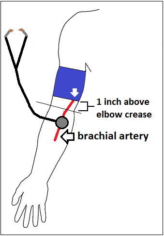 <p>at least 1 inch above the elbow crease</p>