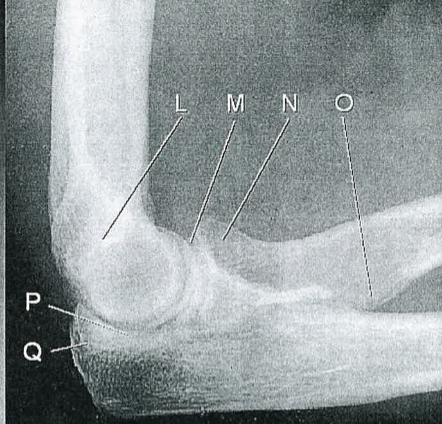 <p>O</p>