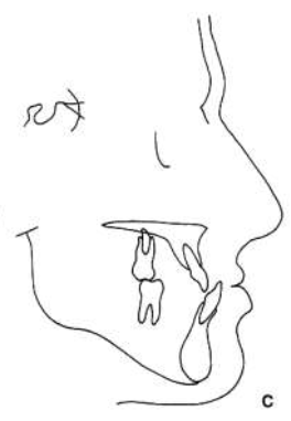 <p>how would you classify this profile </p>