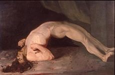 <p>Abnormal posture seen in severe tetanus --> the back becomes extremely arched due to muscle spasms</p>