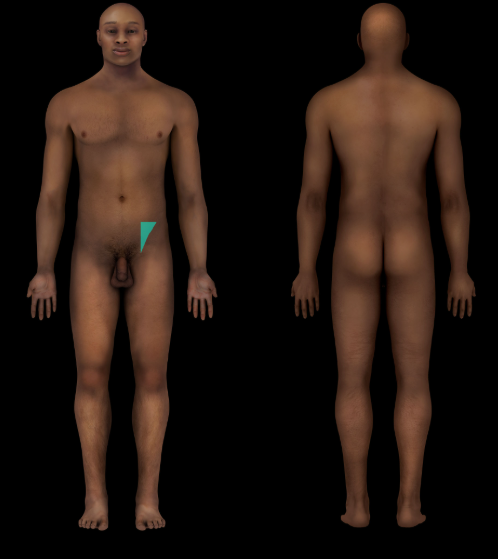 term image