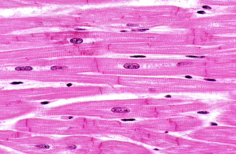 <p>Only found in heart, branched, has intercalcated disc, lightly striated, 1-2 nuclei per cell</p>