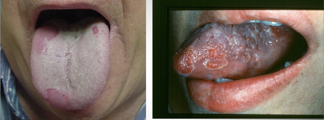 <p>What is this condition?</p>