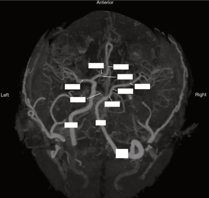 <p>Label the circle of willis </p>