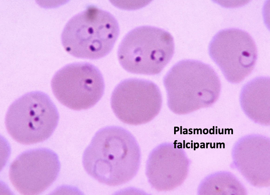 <ul><li><p><span>protozoan parasite</span></p></li><li><p><span>causes malaria </span></p></li></ul><p></p>