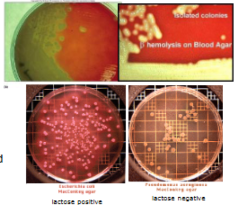 <p>contain substances that are changed by bacteria in recognizable ways </p><p>example: </p><ul><li><p>blood agar</p><ul><li><p>identifies bacteria that produce hemolysin (break down RBCs)</p><ul><li><p>hemolysis</p></li></ul></li></ul></li><li><p>MacConkey agar </p><ul><li><p>contains lactose and pH indicator → identify bacteria that produce acid from lactose </p></li></ul></li></ul><p></p>