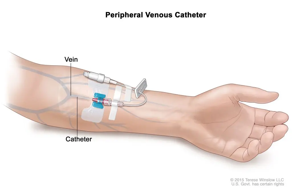 <p>Medical method used to deliver fluids, medications, nutrients, or blood directly into a person’s bloodstream</p>