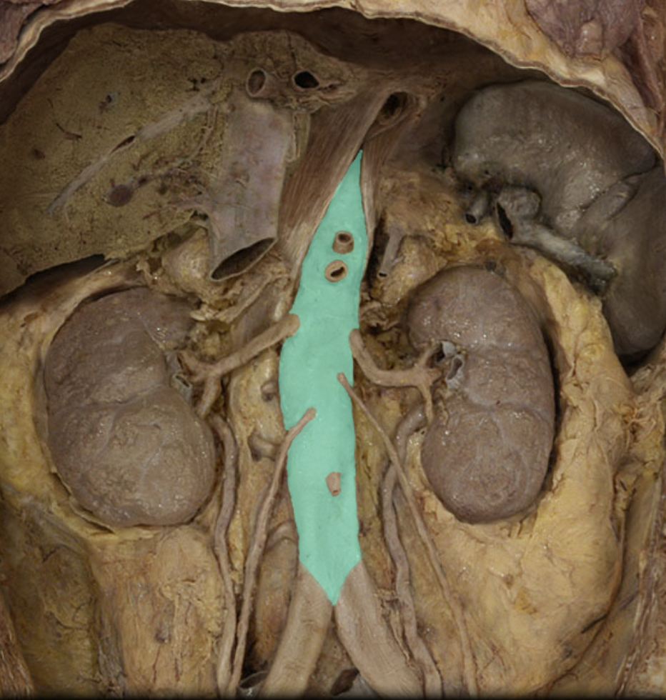<p>Identify the artery of the head/neck/body cavities</p>