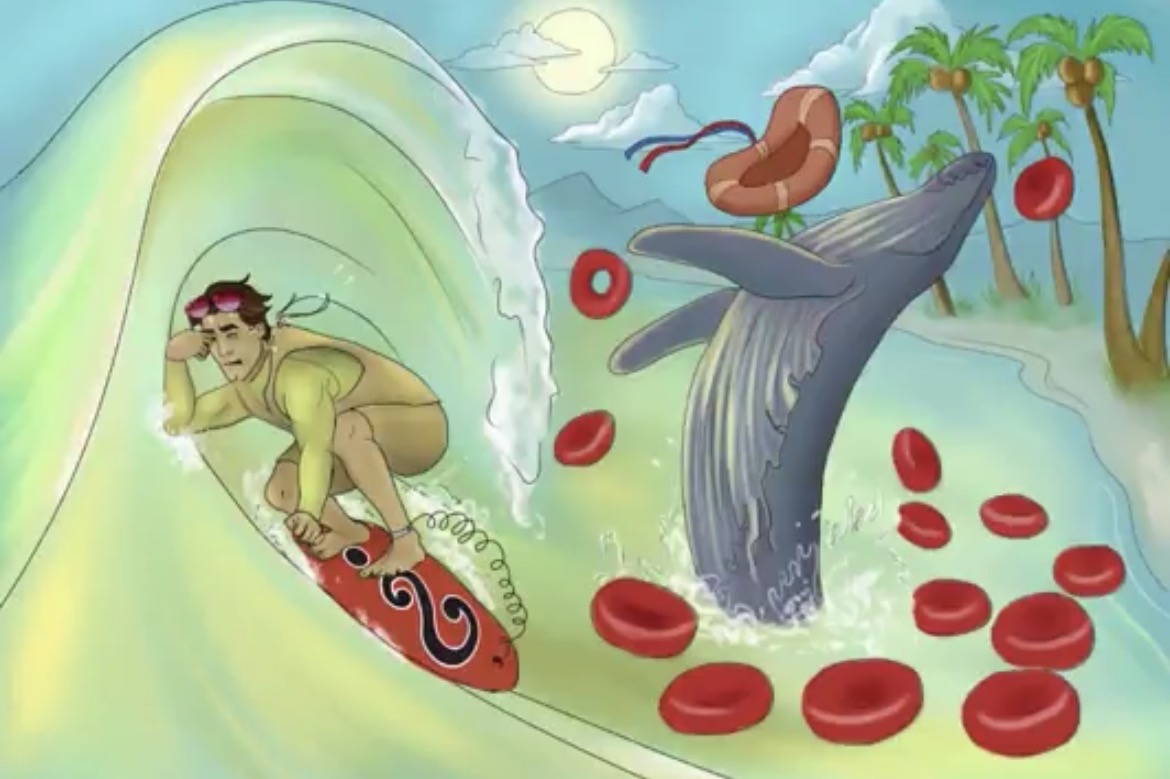 <p>-leptospirosis(aka: Weil’s disease)</p><p>-spirochete; borrelia and syphilis</p><p>-water contaminated by animal urine</p><p>-conjunctival suffusion(redness around eyes), renal and liver damage</p>