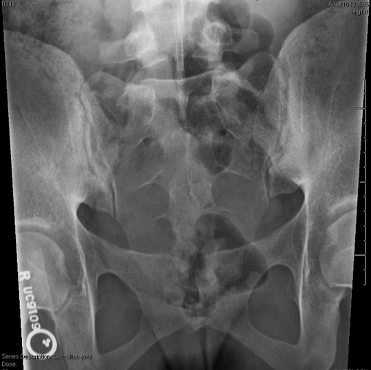 <p>critique this AP axial SI joint</p>