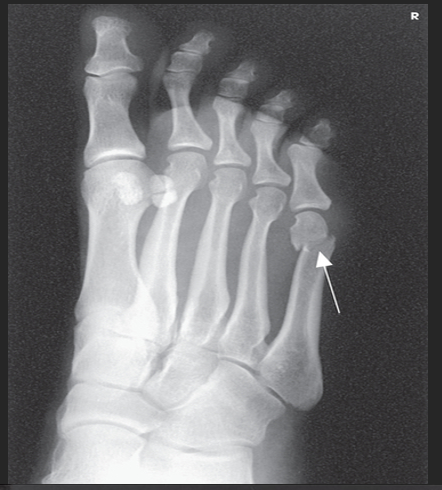 <p>What could be done to demonstrate the opposite aspect of the foot?</p>