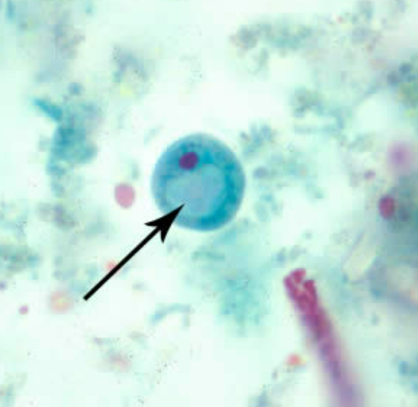 <ol><li><p>Iodamoeba buetschlii</p></li><li><p>Cyst</p></li><li><p>Glycogen vauole</p></li><li><p>Contaminated hog feces</p></li></ol><p></p>
