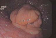 <p>Is this an estrus or diestrus mare cervix?</p>