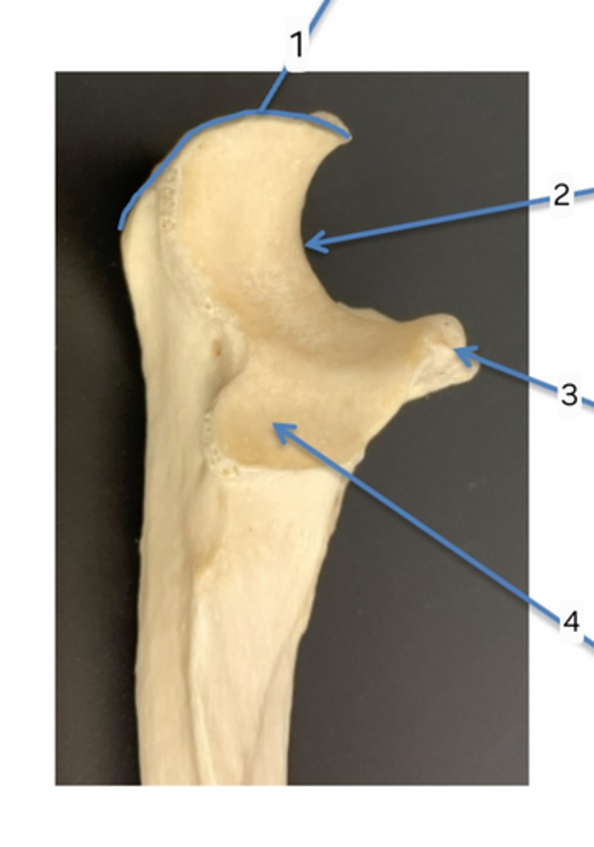 <p>bone?</p>