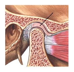 <p>made of fibrocartilage, attaches into joint capsule, separates TMJ into upper and lower joint parts</p>