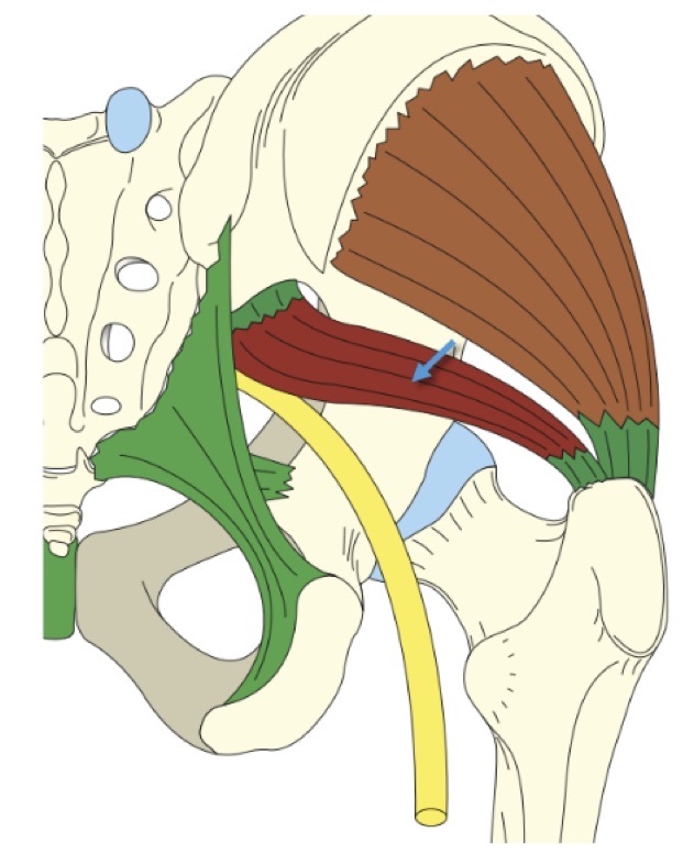 <p>FAUX : il traverse la grande incisure ischiatique</p>