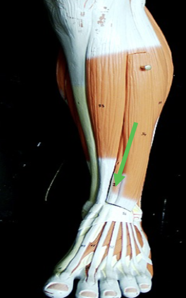 <p>Identify the muscle indicated by the pointer.</p>