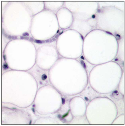 <p>Matrix as in areolar, but very sparse; closely packed adipocytes, or fat cells, have nucleus pushed to the side by large fat droplet. Little matrix, cells are packed tight. Provides reserve food fuel; insulates against heat loss; supports and protects organs. Shock absorption, insulation, energy storage. Under skin in subcutaneous tissue; around kidneys and eyeballs; within abdomen; in breasts.</p>