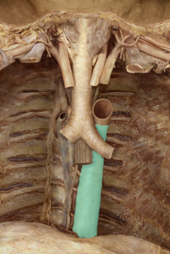 <p>Identify the artery of the head/neck/body cavities</p>
