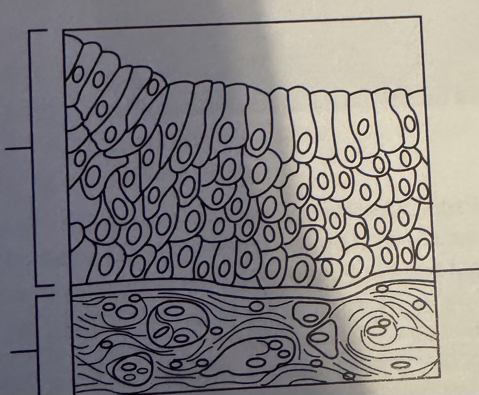 <p>What kind of epithelial tissue is this?</p>
