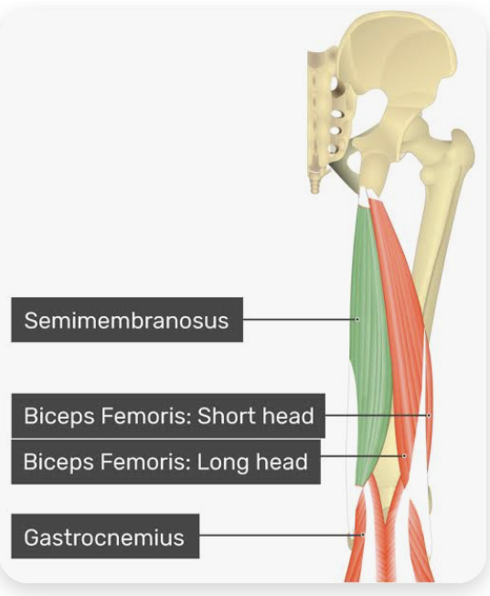 <p>O: Tuberosity of the ischium</p><p>I: Dorsal surface of the medial condyle of the tibia</p><p>A: Flexion of the leg; internal rotation of the flexed leg; extension of the thigh</p><p>N: Tibial nerve</p>