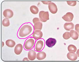 <p>what kind of erythrocyte cell is this?</p>