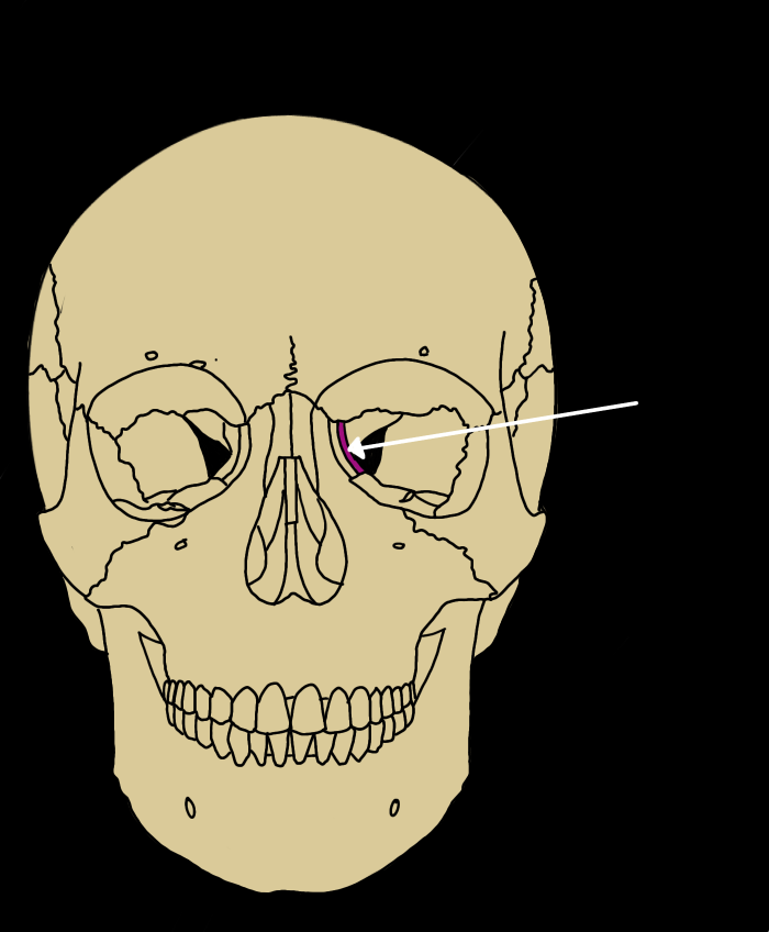 term image