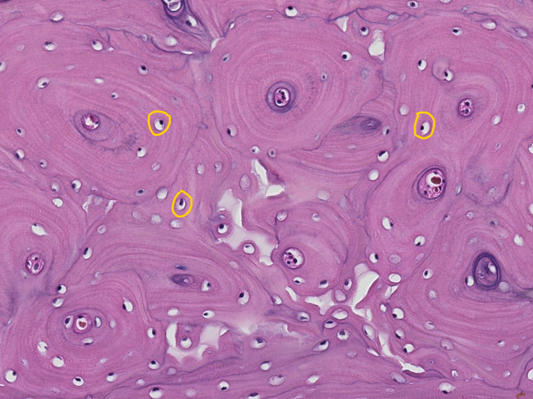 <p><span style="font-family: "Calibri Light";">This is the diaphysis (shaft) of a long bone in transverse (cross) section. <br>ID the encircled structures within the osteon.</span></p>