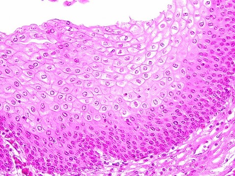 <p>what is this tissue?</p>