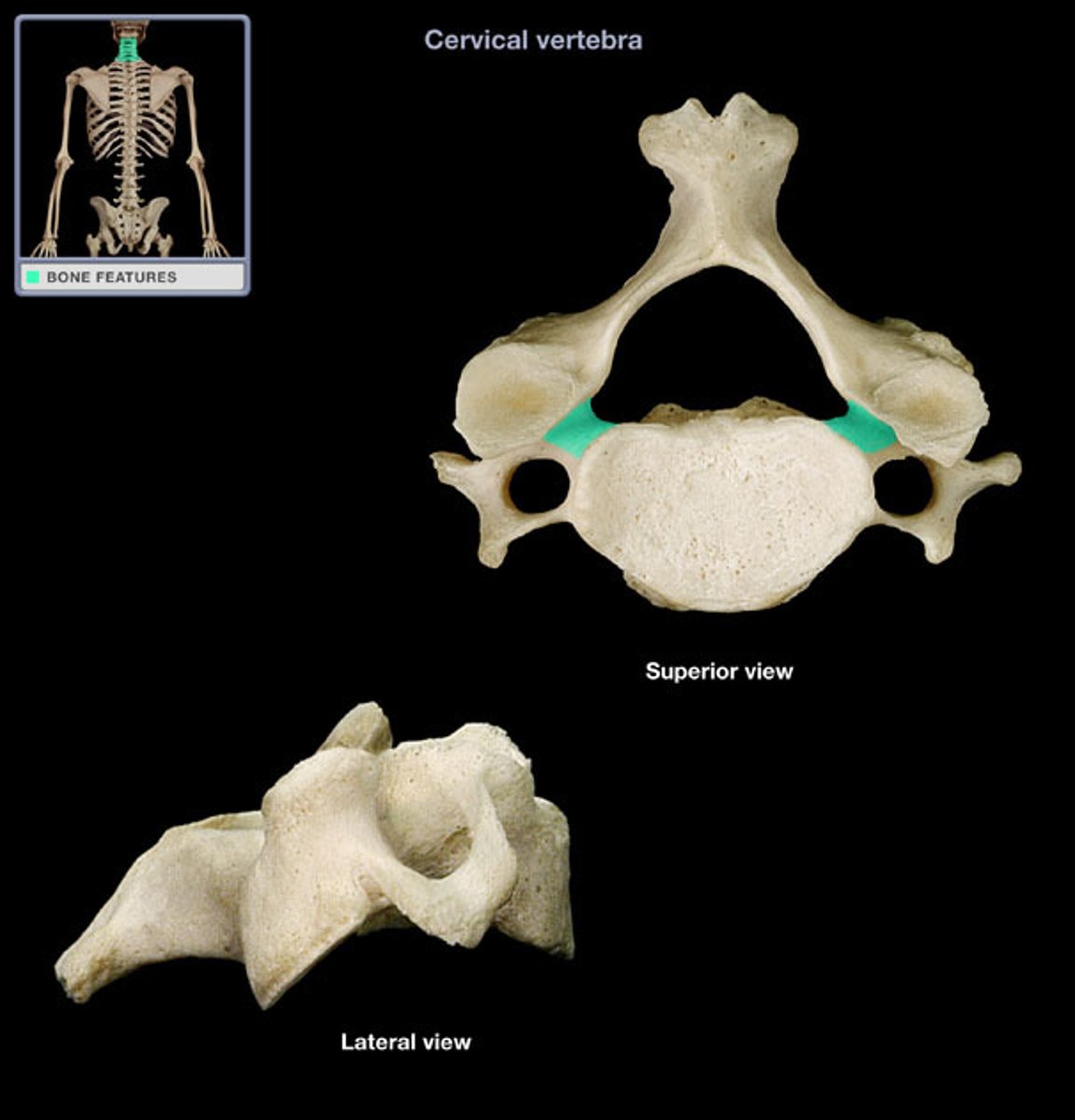 <p>(name of the vertebra part)</p>