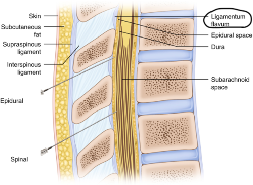 <p>Skin, subcutaneous fat, supraspinous ligament, interspinous ligament, ligamentum flavum, epidural space, dura mater, subdural space, arachnoid mater, subarachnoid space</p>