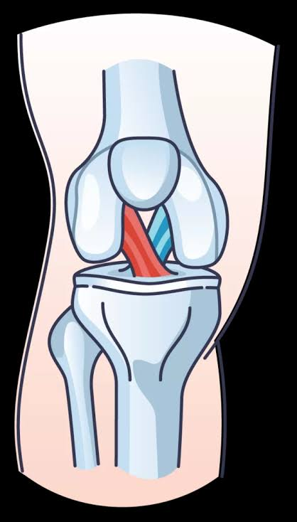 <p>ANTERIOR ligament that connects the tibia to the femur</p>