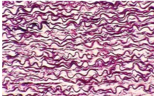 <ul><li><p><span style="background-color: transparent; font-family: "Playfair Display", serif;">Recoil</span></p></li><li><p><span style="background-color: transparent; font-family: "Playfair Display", serif;">Arteries, some ligaments, lungs</span></p></li><li><p><span style="background-color: transparent; font-family: "Playfair Display", serif;">Looks like curly hair strands&nbsp;</span></p></li></ul><p></p>