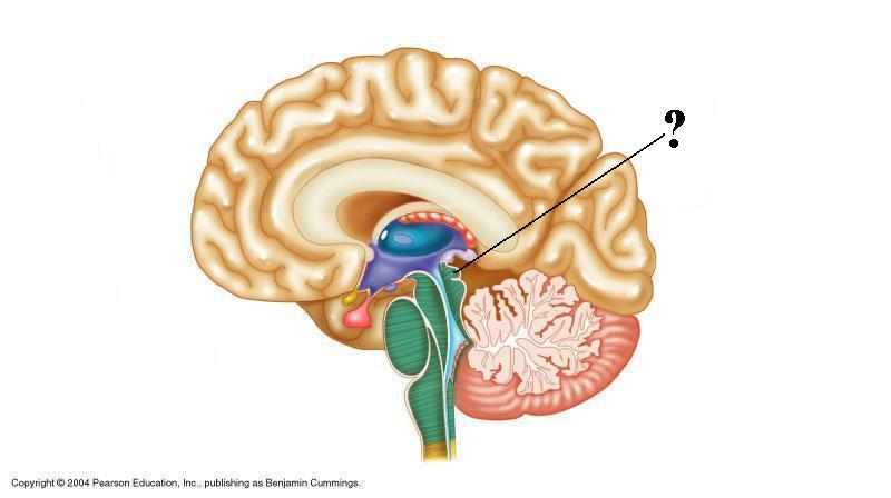 <p>Identify the indicated structure of the brain</p>
